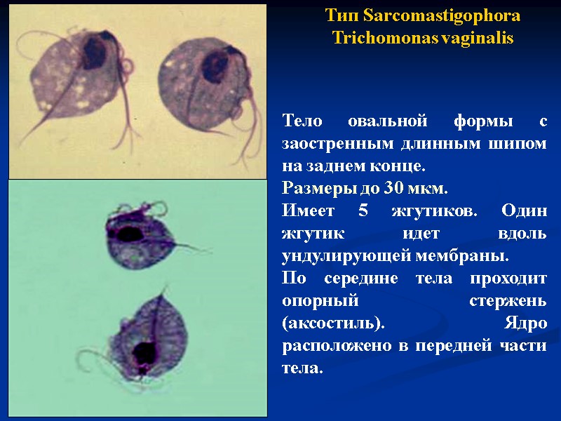 Тип Sarcomastigophora Trichomonas vaginalis Тело овальной формы с заостренным длинным шипом на заднем конце.